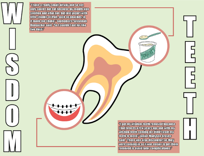 Students share wisdom teeth experiences